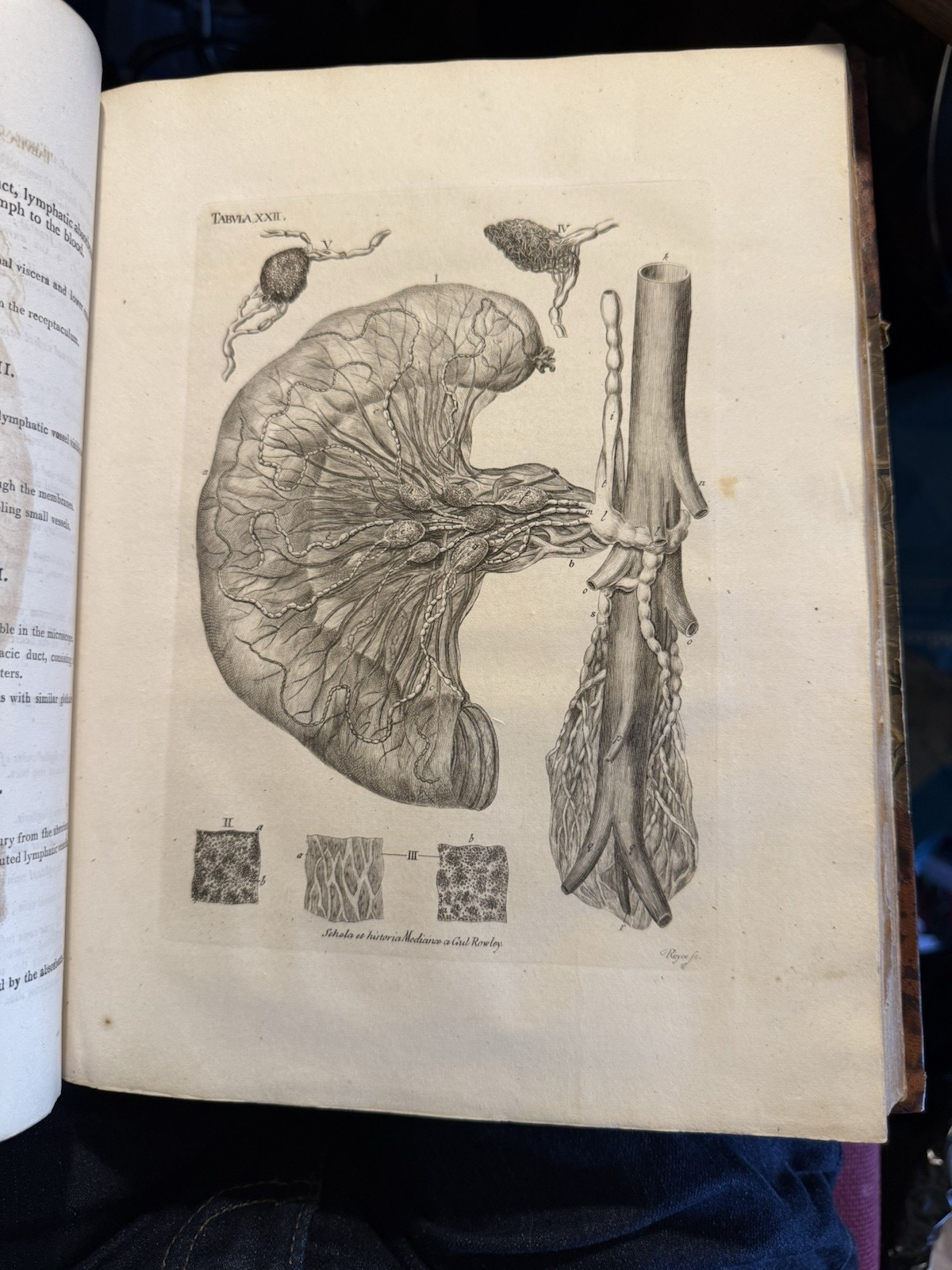 1803 Schola Medicinae; New Universal History and School of Medicine : Rowley