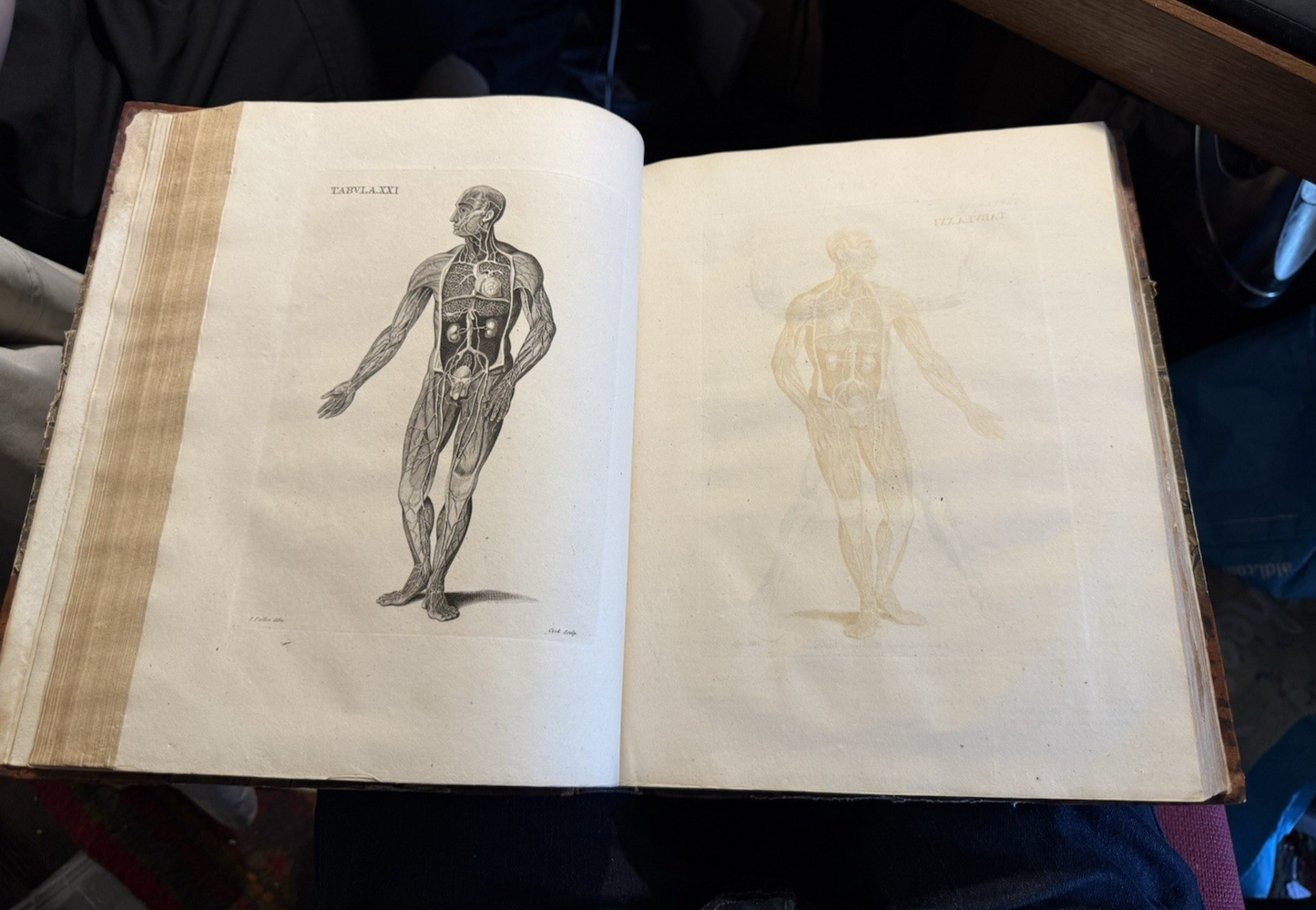 1803 Schola Medicinae; New Universal History and School of Medicine : Rowley