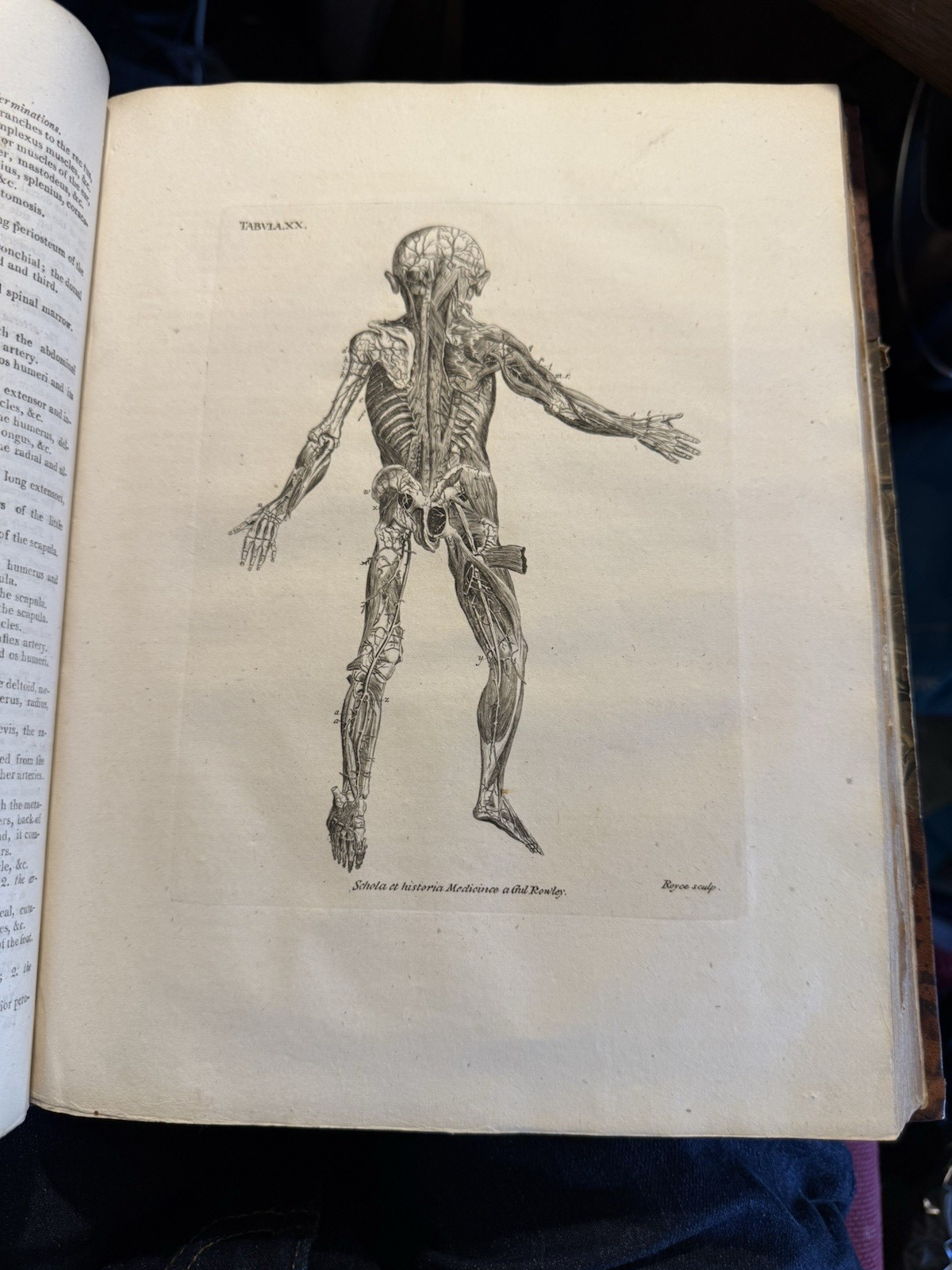 1803 Schola Medicinae; New Universal History and School of Medicine : Rowley