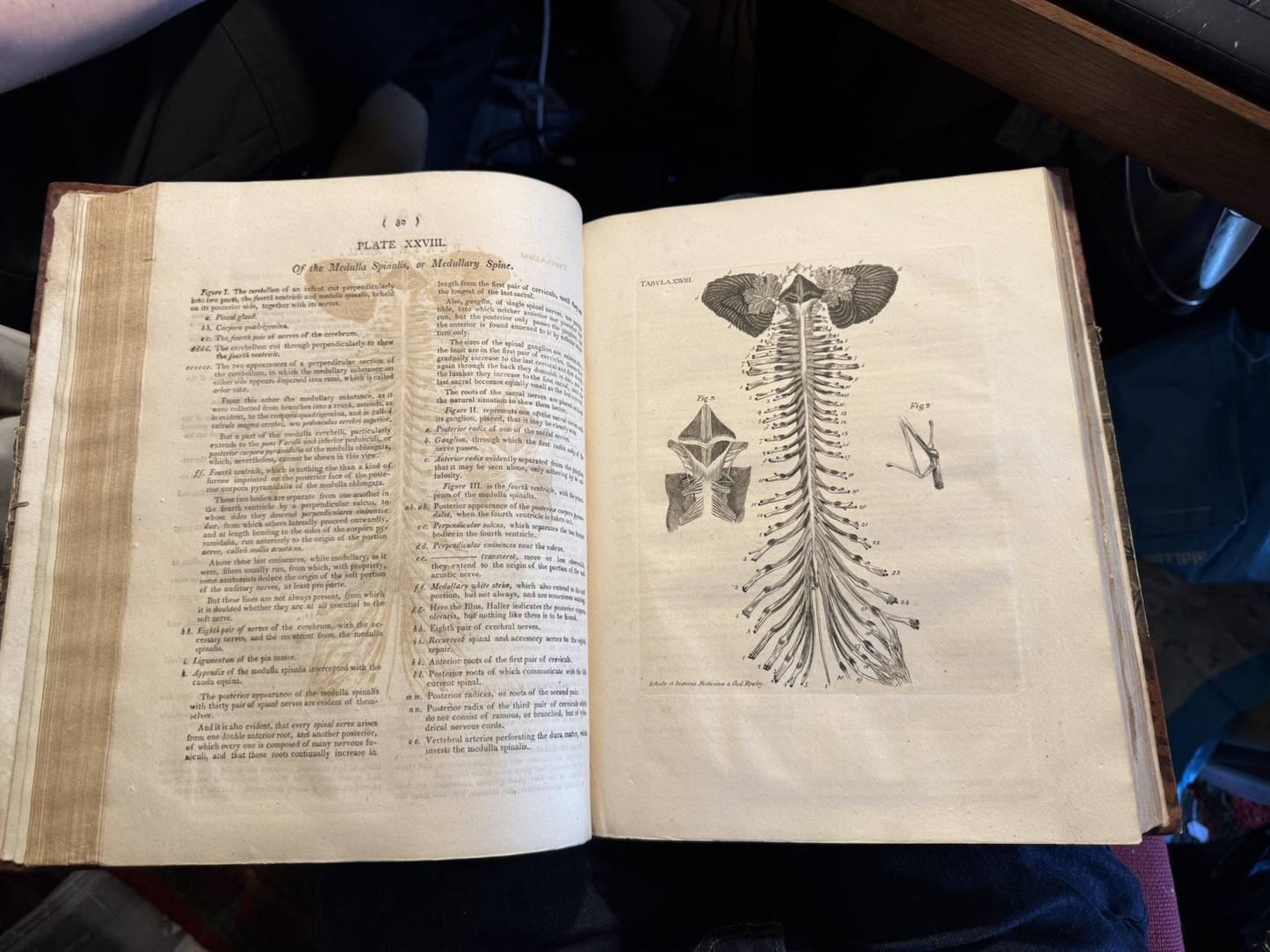 1803 Schola Medicinae; New Universal History and School of Medicine : Rowley