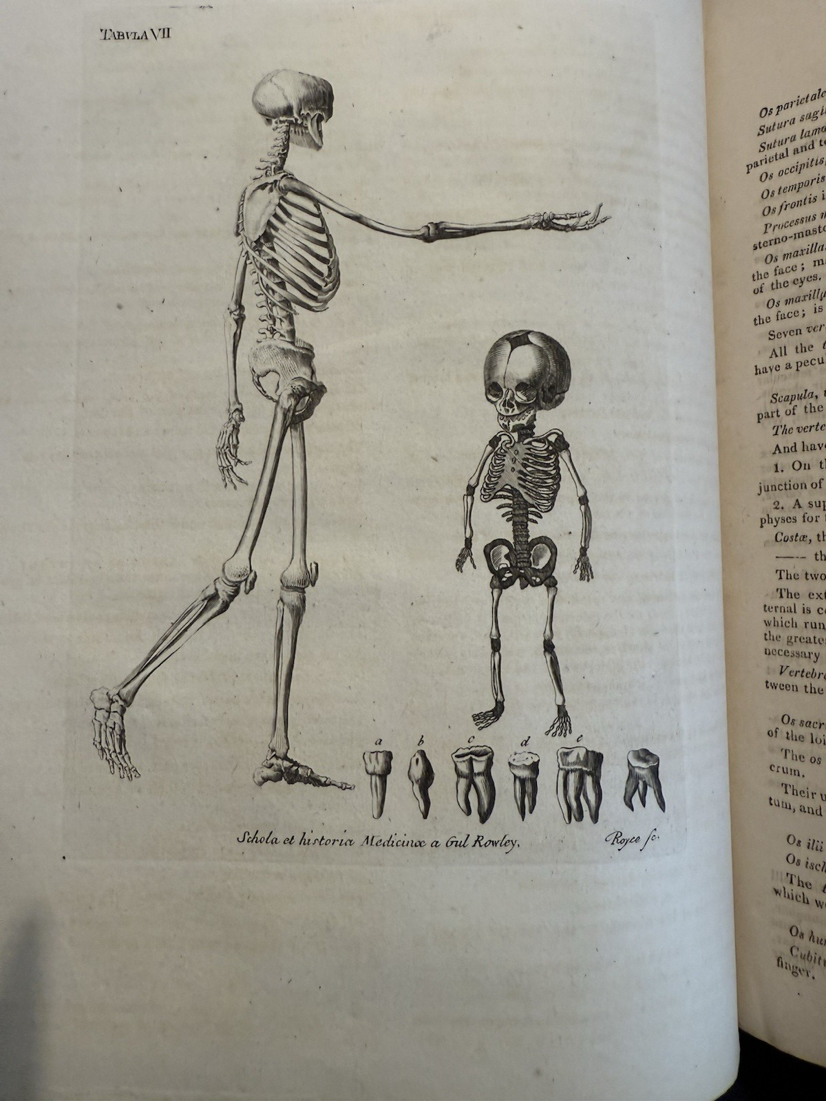 1803 Schola Medicinae; New Universal History and School of Medicine : Rowley