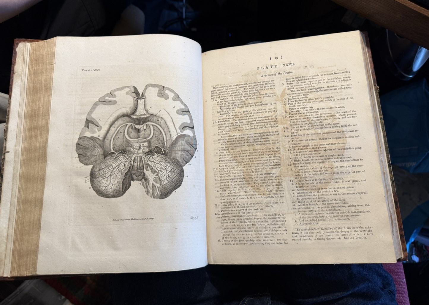 1803 Schola Medicinae; New Universal History and School of Medicine : Rowley
