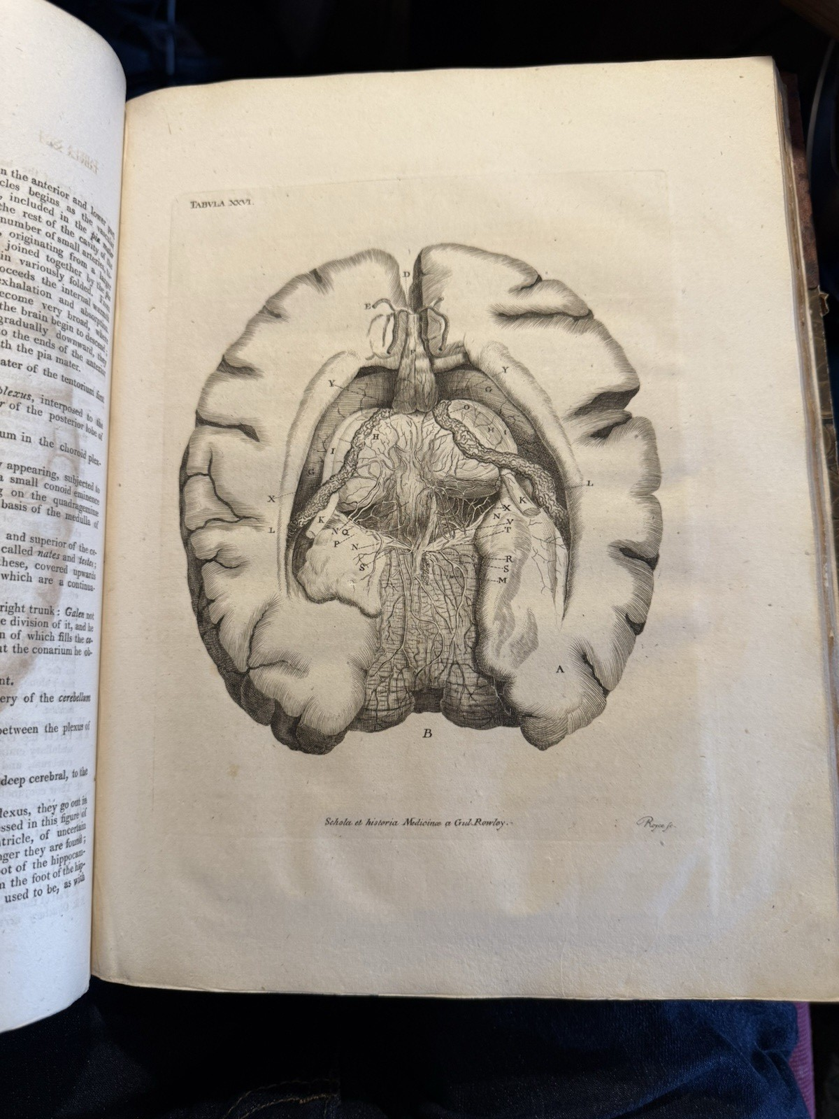 1803 Schola Medicinae; New Universal History and School of Medicine : Rowley