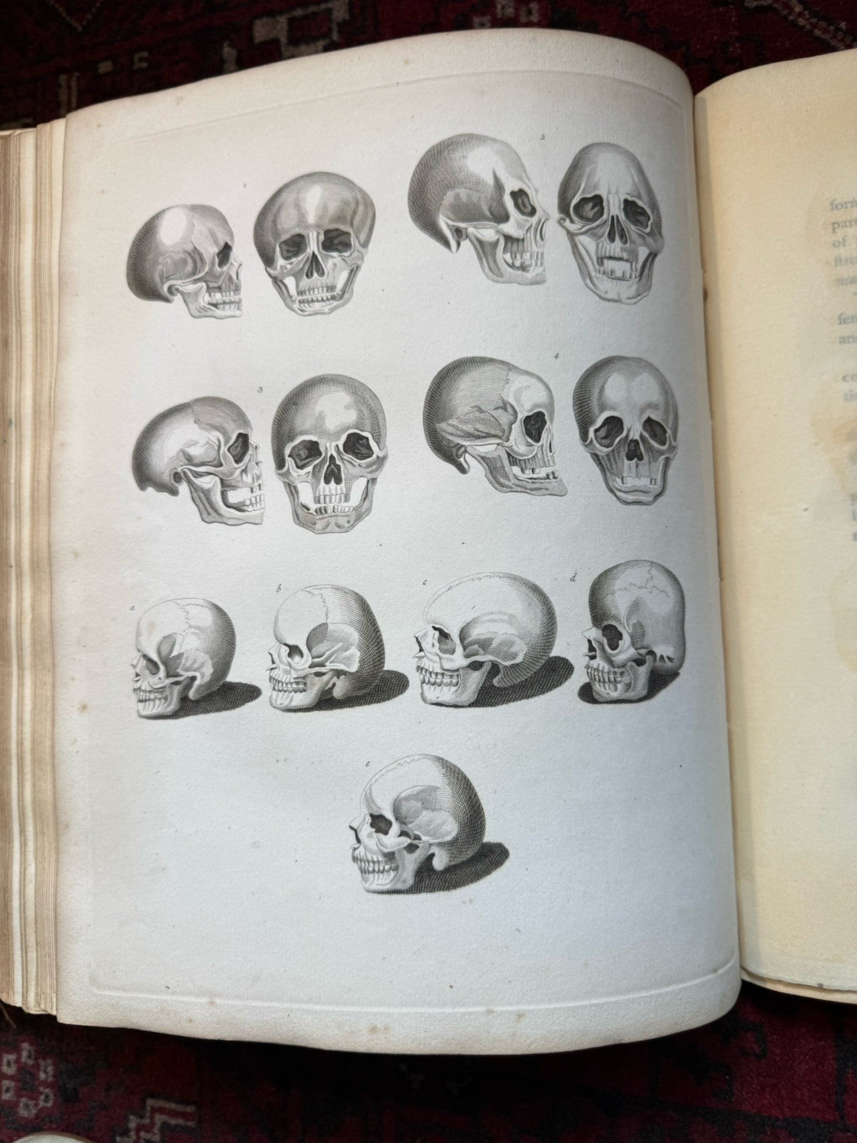 1789 Lavater's Essays on Physiognomy (3 Vols) Psuedo Science : 800+ Engravings