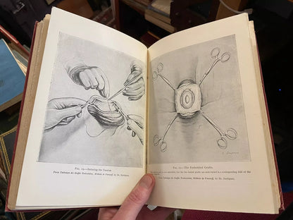 Rejuvenation By Grafting : Testicular Grafting from Monkey to Man : Medical 1925