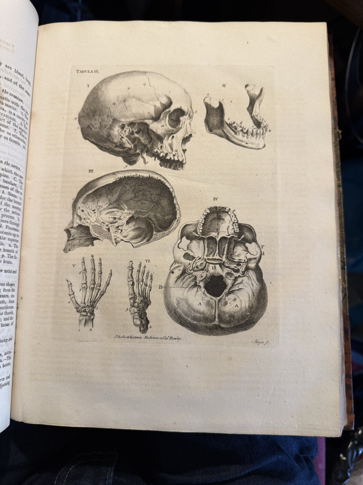 1803 Schola Medicinae; New Universal History and School of Medicine : Rowley