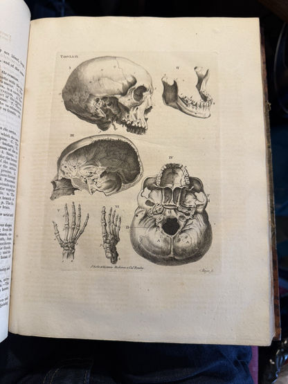 1803 Schola Medicinae; New Universal History and School of Medicine : Rowley