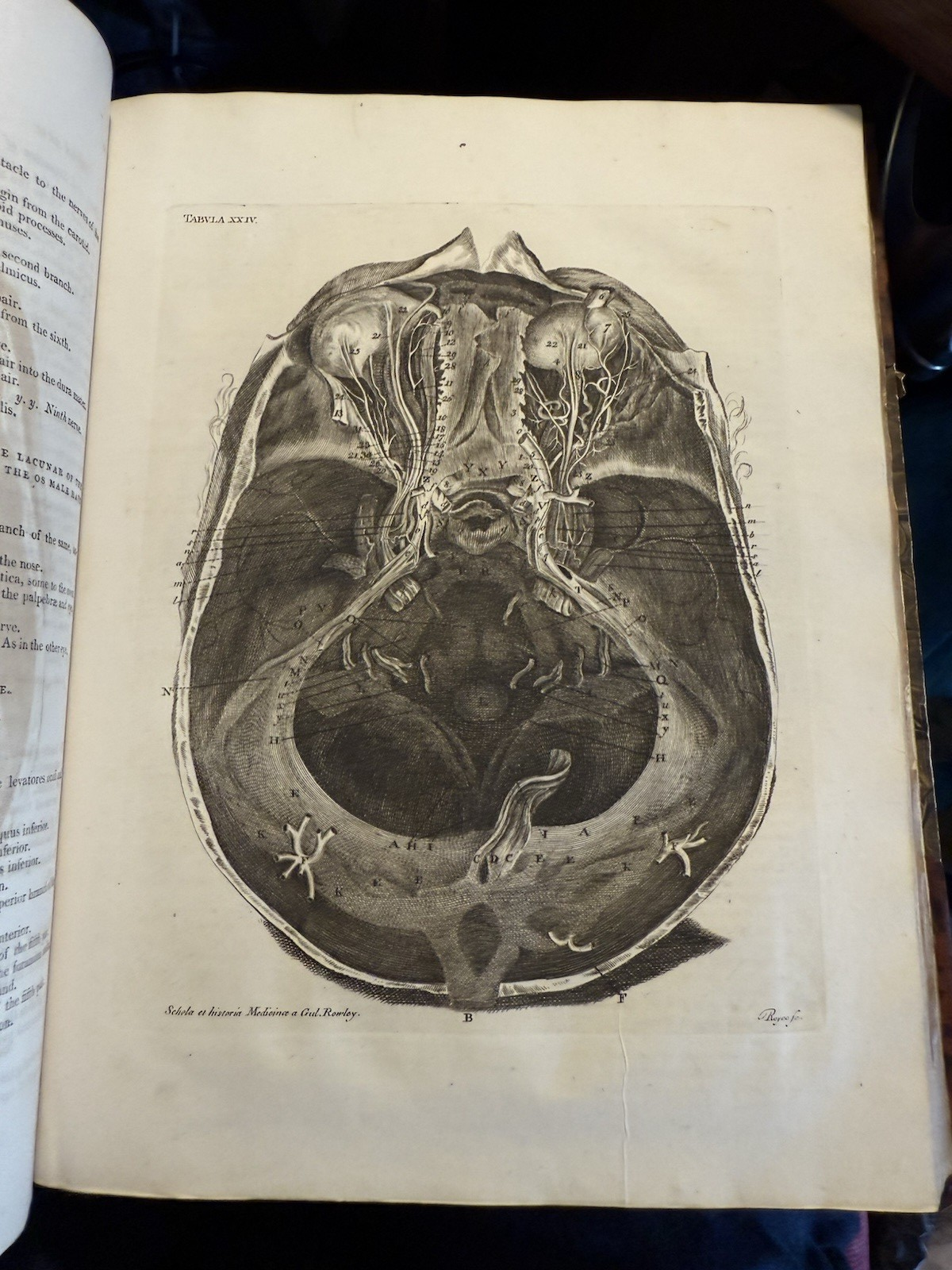 1803 Schola Medicinae; New Universal History and School of Medicine : Rowley