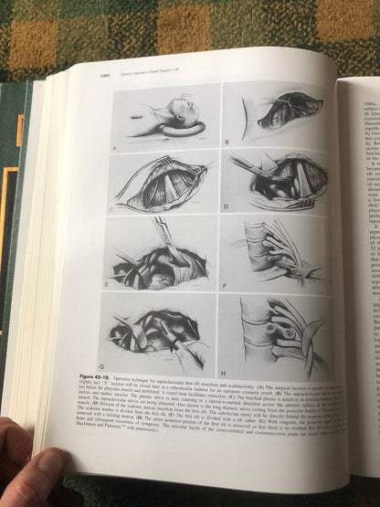 Green's Operative Hand Surgery (Fourth Edition) (Volume 2) Medicine