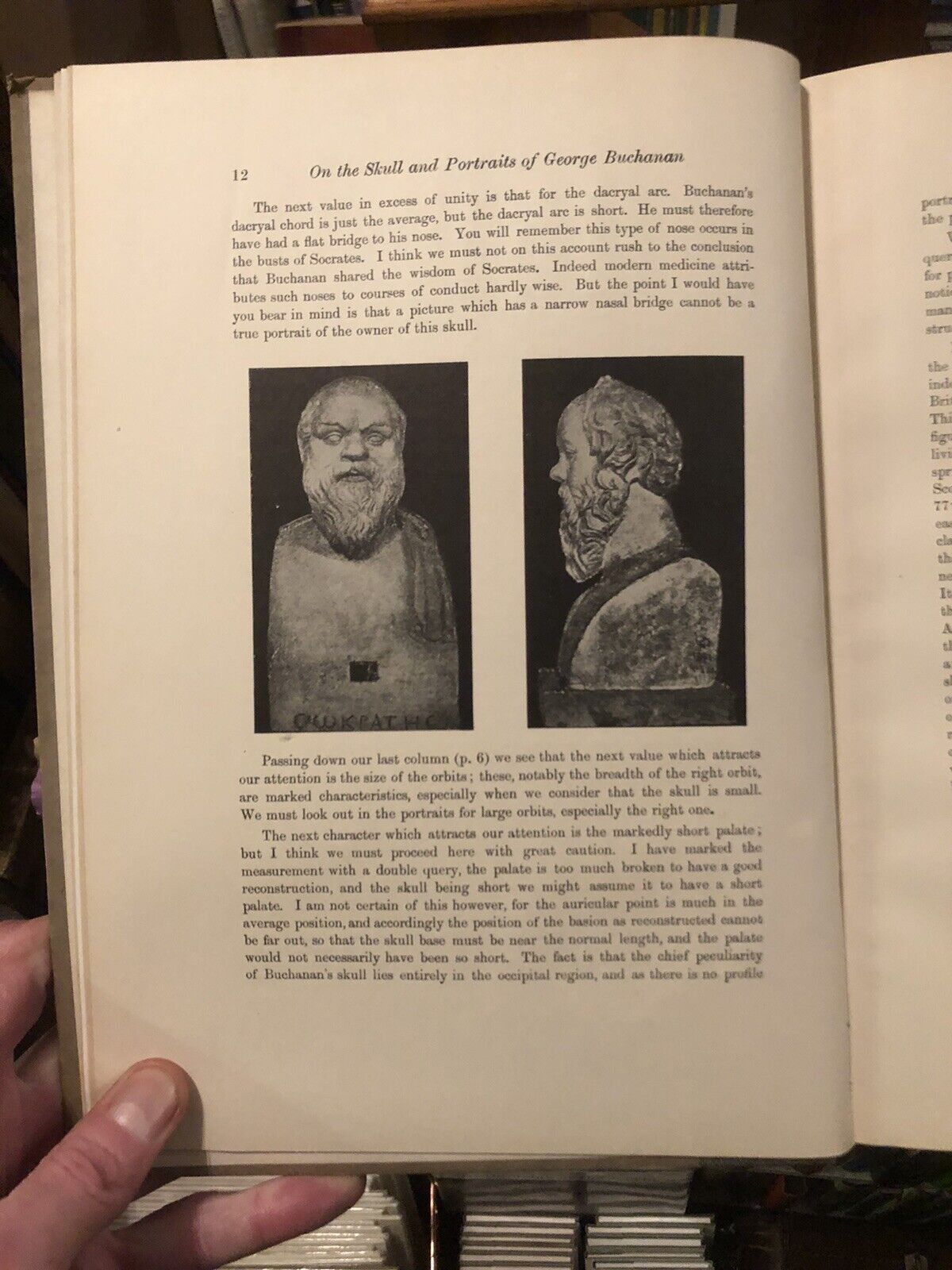 The Skull and Portraits of George Buchanan (Scottish Historian) Pearson 1926