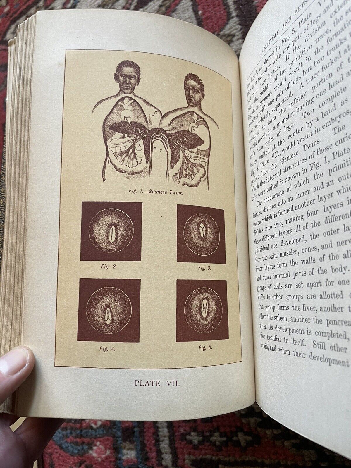 1895 Kellogg's Ladies' Guide in Health and Disease / Remedies / Social Evil